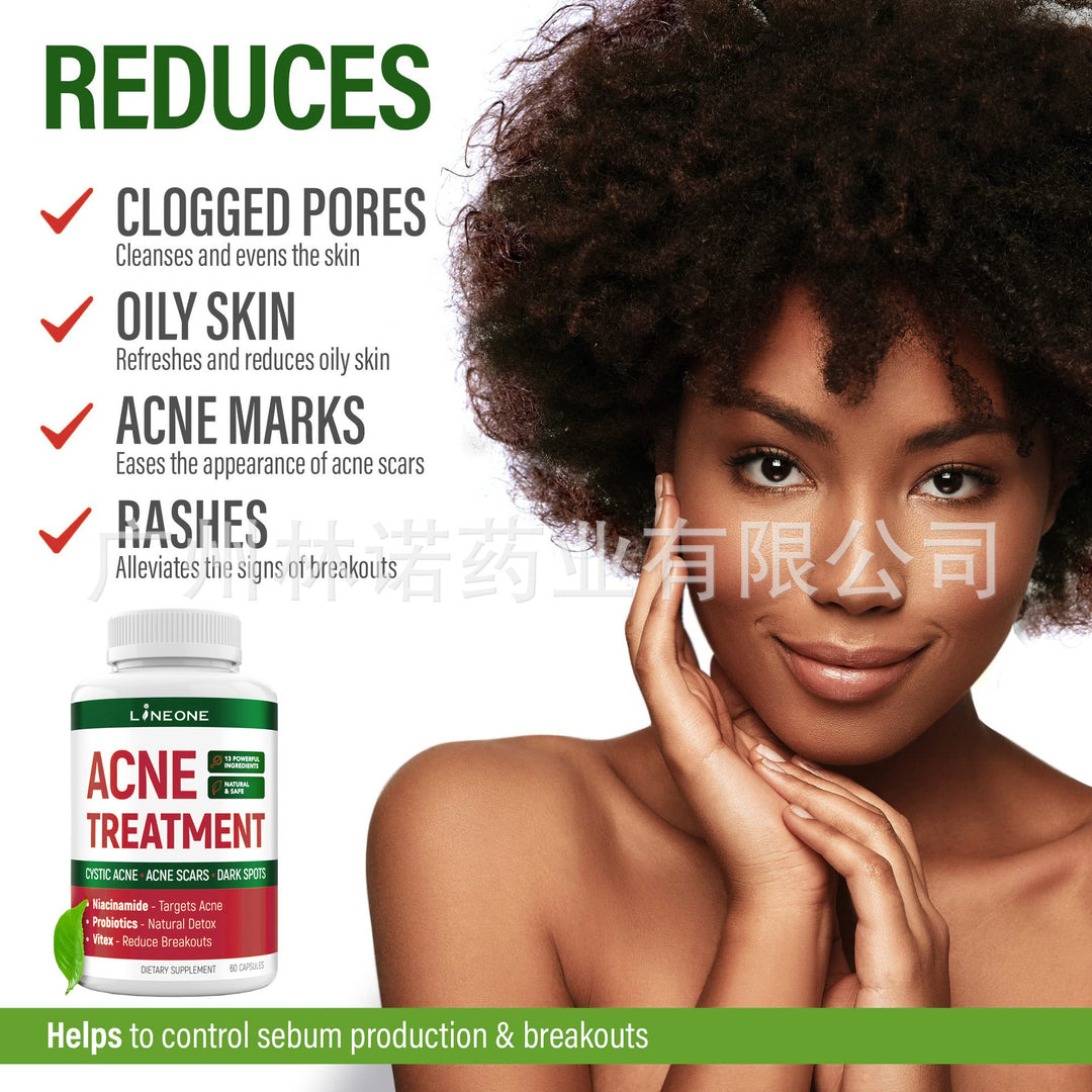 Acne Treatment Capsules